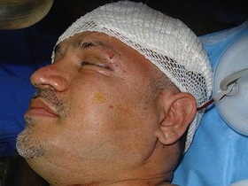 Ali Daei Critically Injured In A Car Accident